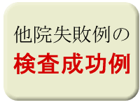 他医院で大腸内視鏡が失敗した方の当院での再検査、成功例