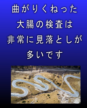 曲がりくねった大腸の検査は非常に見落としが多い
