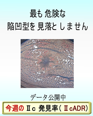 平坦陥凹型（Ⅱｃ型）腺腫検出率（Ⅱｃ_ADR）を毎週、定期公開。世界的に例の無い、当院の試み