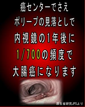 癌センターでさえ１年後の内視鏡後・大腸癌（PCCRC）は７００分の１と多い