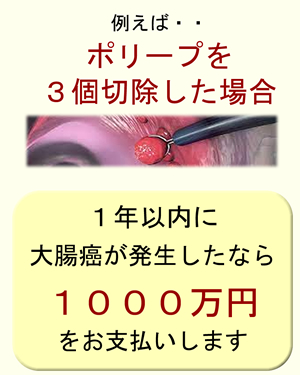 例えばポリープが３個なら。１年以内の内視鏡後・大腸癌（PCCRC）に１０００万円を支払うことを約束