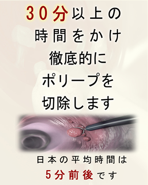 観察に３０分以上をかけることを保証。徹底的にポリープを切除しクリーンアップする。参考として日本の医師の平均観察時間は５分